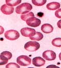 Normal Blood smear